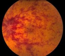 ����Ĥ���뾲����������ʲôԭ������ģ�