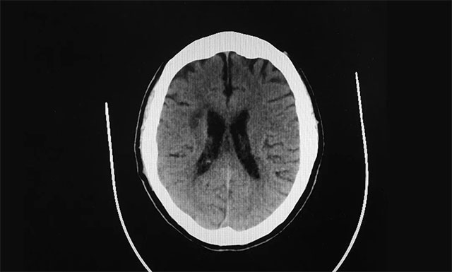 ���߶෢���Թ�����ʹ˫��֫��ϰ�