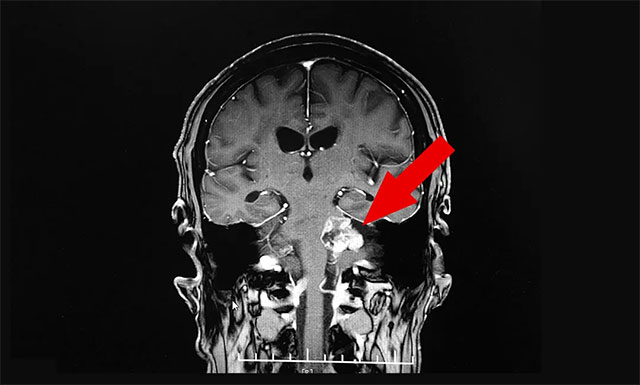 ϸ�ĵ������η����˻��ߵ��²�֢��������������